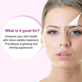 Listing 4 of 4 for 6 In 1 Derma Roller Kit For Face And Body - 0.25mm And 0.3mm Micro Needle Dermar