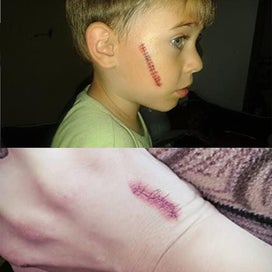 Listing 5 of 5 for Scar Tattoo Stickers Fake Wounds Temporary Tattoo Scar Stickers For Halloween Pa