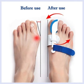 Listing 5 of 7 for NEW 1 Pair Bunion Valgus And Bunion Valgus Corrector Hallux Valgus Corrector