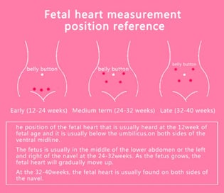 Listing 7 of 15 for Fetal Doppler 3659101
