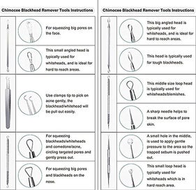 Listing 3 of 5 for Professional Surgical Blackhead Remover Tools, Blemish And Splinter Acne Pimple