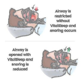 Listing 3 of 3 for Adjustable Silicone Anti-snoring Device - Improve Sleep Quality