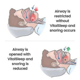 Listing 3 of 3 for Adjustable Mouth Silicone Anti-snoring Device Anti Molar Dental Sleeve