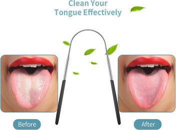 Listing 3 of 5 for 4 Pieces Tongue Scraper Set Bad Breath Reduction Stainless Steel Tongue Clea