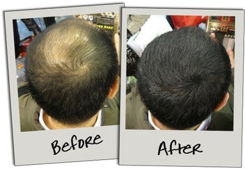 Listing 2 of 2 for Toppik Hair Fibres - Black only 27.5g