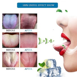 Listing 2 of 5 for [soft Silicon] 3pcs Tongue Scraper Cleaner, Oral Scrapers, Premium Sweeper Sets,