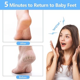 Listing 5 of 5 for Foot Scrubber Files For Callus Remover - Stainless Steel Foot File Foot Grinde