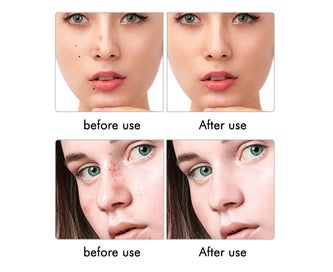 Listing 4 of 8 for Mole Removal Pen 9 Level LCD Plasma Pen Tattoo Mole Removal Pen Portable Skin