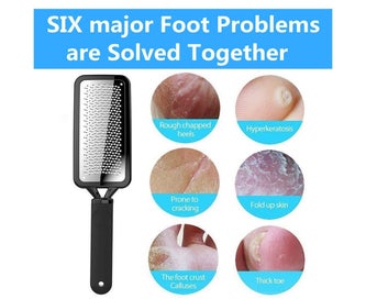 Listing 4 of 5 for Colossal Foot File And Foot Callus Remover, Foot Care Pedicure Rasp Metal S