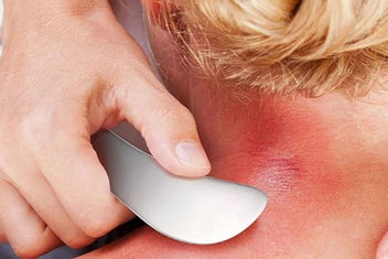 Listing 5 of 10 for 3Pcs Stainless Steel Muscle Scraper Tools Scraping Massage Tools