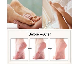 Listing 2 of 8 for Electric Care Pedicure Set Foot File Hard Dead Skin Callus Remover Foot Grinder