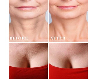 Listing 3 of 10 for 2Pcs Anti Wrinkle ChestNeck Pad Silicone Removal Patch Skin Care Reusabl