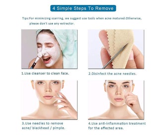 Listing 5 of 6 for 4PCS Blackhead Remover Pimple Comedone Extractor Tool Acne Kit