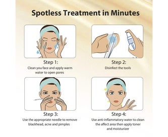 Listing 8 of 8 for 5-Piece Set Blackheads Blemish Removing Acne Whitehead Removal Kit Pimple E