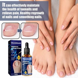 Listing 3 of 10 for 3x 2023 Best German Toenailplus NailProp Anti Paronychia Relief Oil NEW