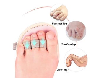 Listing 3 of 10 for Toe Separators