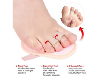 Listing 5 of 10 for Toe Separators