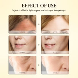 Listing 9 of 9 for Bee Venom Essence, Bee Venom Anti-Wrinkle Essence, Bee Venom Firming Spray