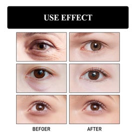 Listing 7 of 10 for Temporary Face Tightener Eye Tightener Cream