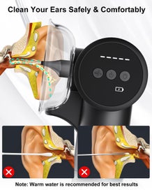 Listing 6 of 6 for Ear Wax Removal Kit, Ear Cleaner with 5 Pressure Irrigation Flushing System