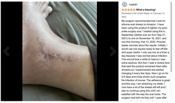 Listing 15 of 20 for Silicone Scar Sheets Silicone Scar Tape Roll Scar Silicone Strips 4cm x 3m