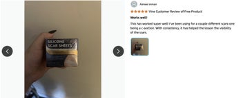 Listing 18 of 20 for Silicone Scar Sheets Silicone Scar Tape Roll Scar Silicone Strips 4cm x 3m