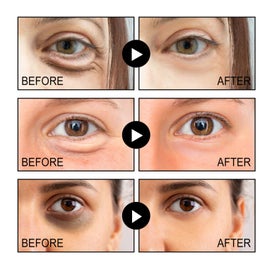 Listing 4 of 9 for Face Eye Tightener