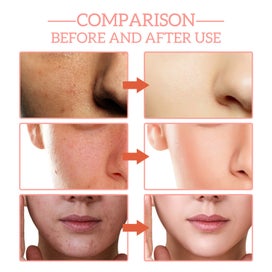 Listing 6 of 10 for Anti-Wrinkle Firming Cream (Auckland Stock)