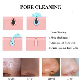 Listing 6 of 9 for Blackhead Removal Pore Tightening Mud Mask