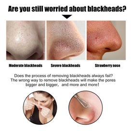 Listing 5 of 9 for 10Pcs Pore Strips for Blackheads