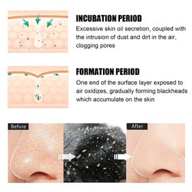 Listing 6 of 9 for 10Pcs Pore Strips for Blackheads