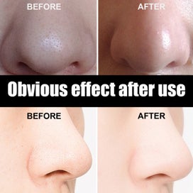 Listing 8 of 9 for 10Pcs Pore Strips for Blackheads