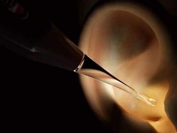 Listing 6 of 6 for LED Lighted Ear Cleaner Kit USB Rechargeable Ear Wax Removal Tool Purple