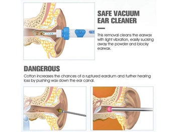 Listing 4 of 12 for Electric Ear Wax Remover NZ Clearance