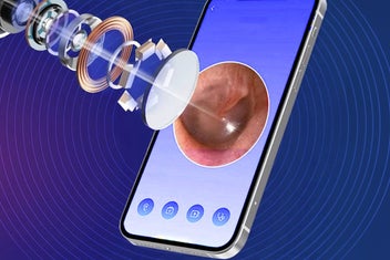 Listing 8 of 9 for Visual Ear Cleaner with Camera Ear Wax Removal-Blue