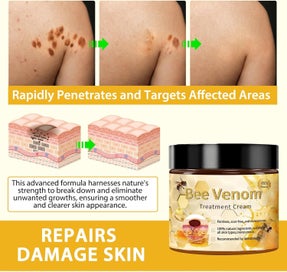 Listing 2 of 8 for 60g Bee-Venom Wart and Tag Remover Bee-Venom Mole & Wart Treatment Cream