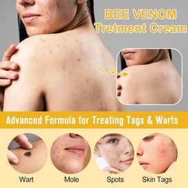 Listing 3 of 8 for 60g Bee-Venom Wart and Tag Remover Bee-Venom Mole & Wart Treatment Cream