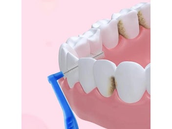 Listing 5 of 10 for 100pcs Orthodontic Interdental Brushes For Teeth Cleaning