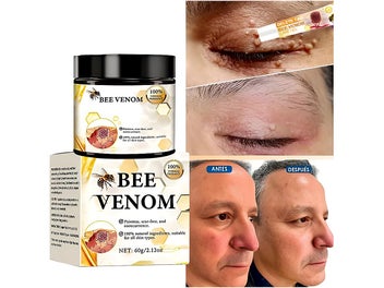 Listing 8 of 8 for 60g Bee-Venom Wart and Tag Remover Bee-Venom Mole & Wart Treatment Cream