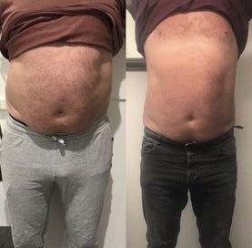 Listing 8 of 9 for Professional Fat Freezing and Muscle Toning Machine - Clinic Ready