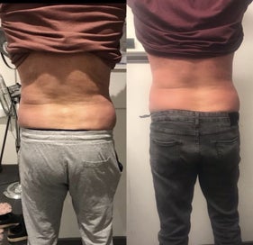 Listing 9 of 9 for Professional Fat Freezing and Muscle Toning Machine - Clinic Ready