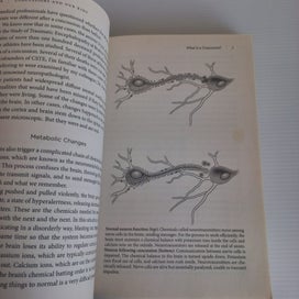 Listing 13 of 15 for Concussions And Our Kids by Robert Cantu, M.D. and Mark Hyman - Leading Expert