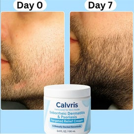 Listing 6 of 11 for 2pcs Calvris Seborrheic Dermatitis & Psoriasis Treatment Cream Beard Recovery...