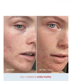 Listing 3 of 3 for FIRST AID Ultra Repair Cream - From SEPHORA RRP $89