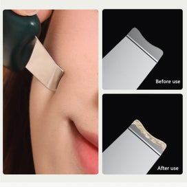 Listing 5 of 9 for Blackhead Remover Tools - Nose Scraper for Blackheads Pore Clean Scraper Fa