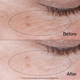 Listing 11 of 13 for Neutrogena Collagen Eye Gel Cream 14g